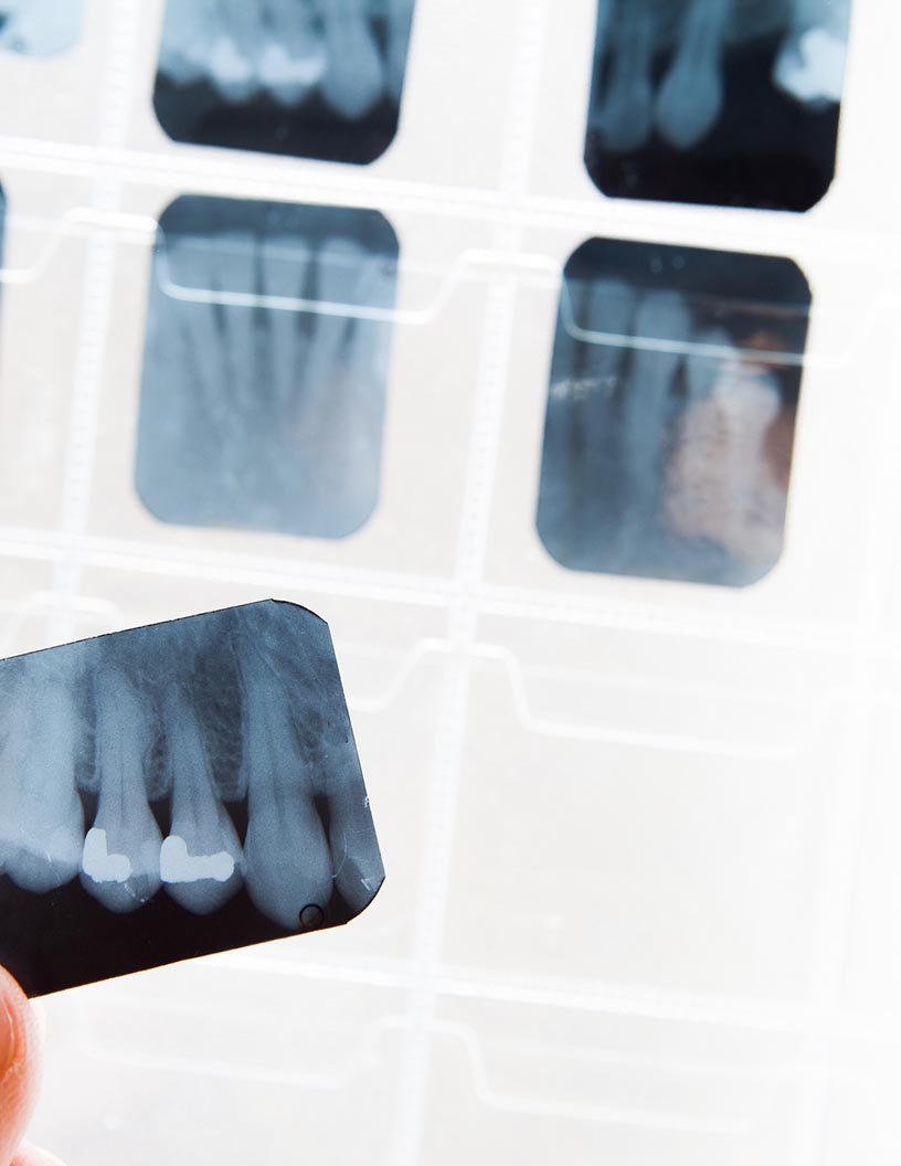 Medical X-Ray Films Market Analysis North America, Europe, APAC, South America, Middle East and Africa - US, Germany, UK, China, Canada - Size and Forecast 2024-2028