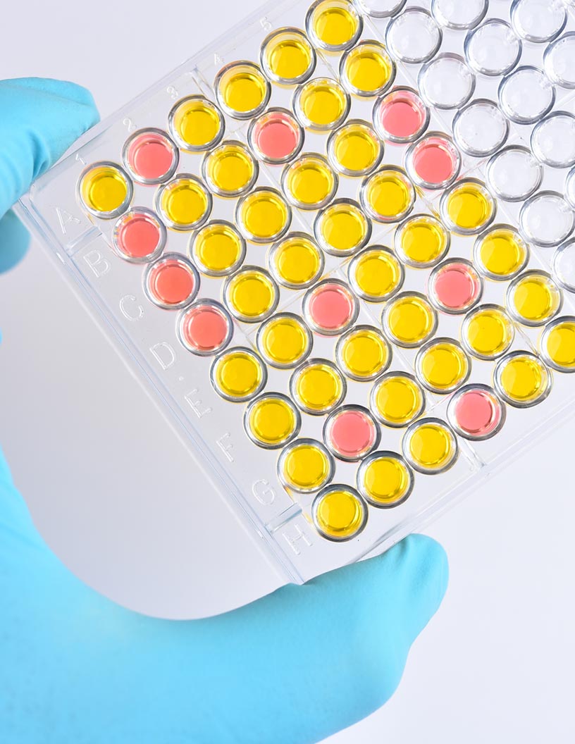 Chemiluminescence Immunoassay Analyzers Market Analysis North America, Europe, APAC, Rest of World (ROW) - US, UK, Canada, Germany, France - Size and Forecast 2024-2028