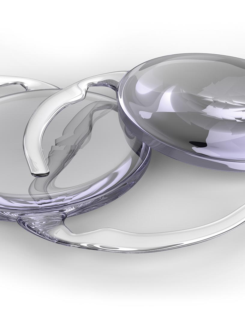 Intraocular Lens Market Analysis India - Size and Forecast 2024-2028
