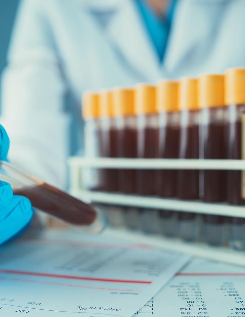 Vacuum Blood Collection Tube Market Analysis North America, Europe, Asia, Rest of World (ROW) - US, Germany, UK, China, Canada - Size and Forecast 2024-2028