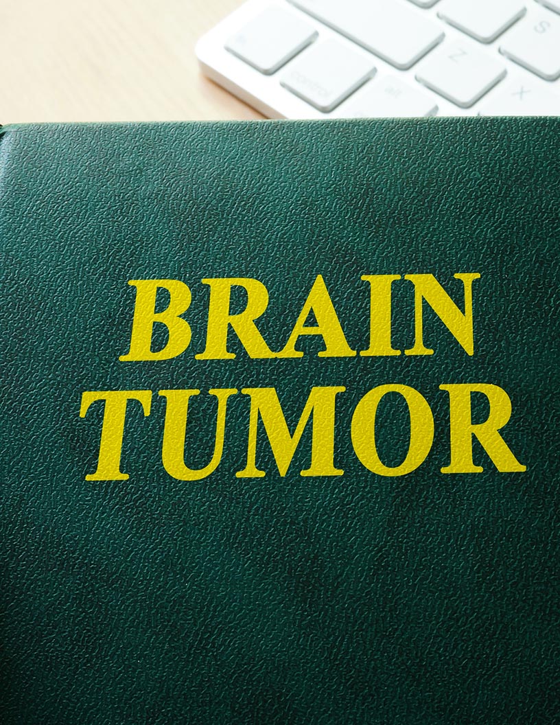 Brain Tumor Therapeutics Market by Type and Geography - Forecast and Analysis 2021-2025