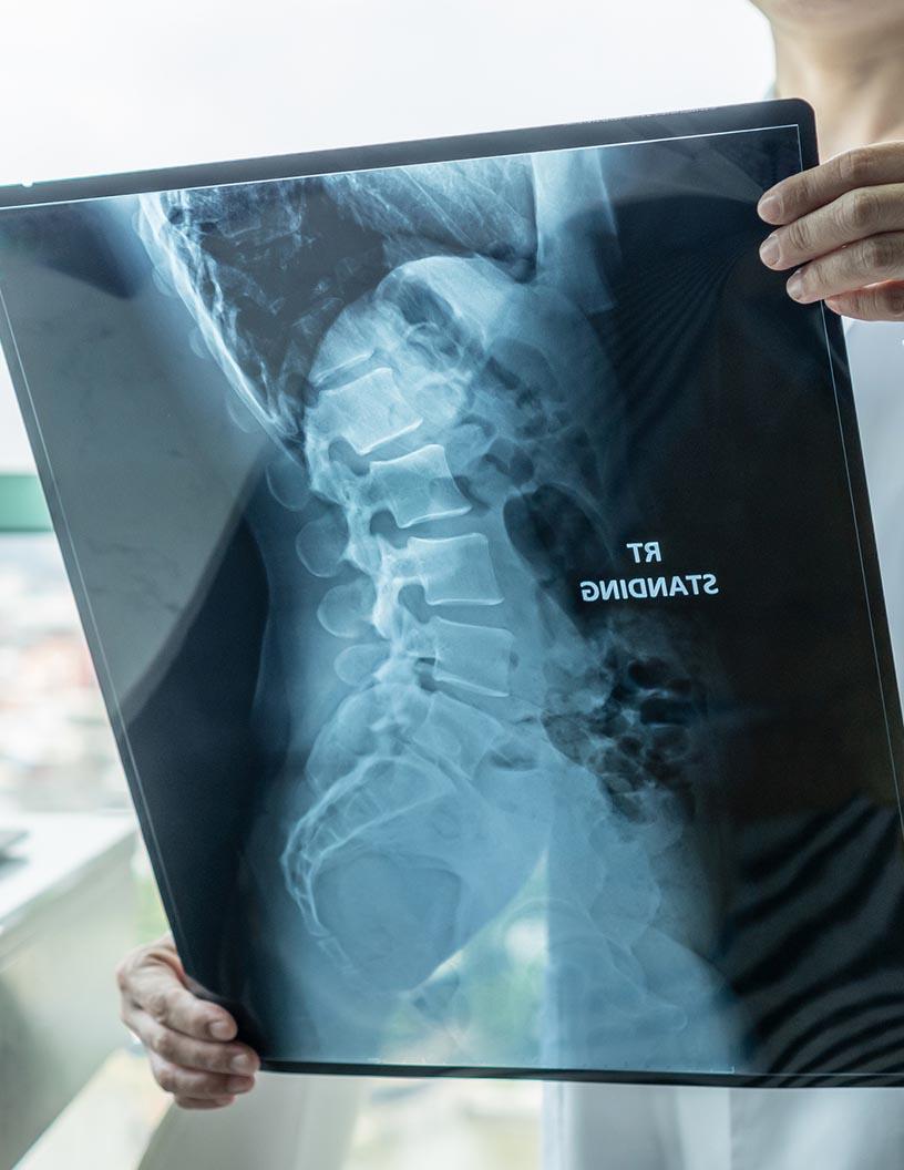 Neuromuscular Disease Therapeutics Market Analysis, Size, and Forecast 2025-2029: North America (US and Canada), Europe (France, Germany, Italy, and UK), Middle East and Africa (Egypt, KSA, Oman, and UAE), APAC (China, India, and Japan), South America (Argentina and Brazil), and Rest of World (ROW)