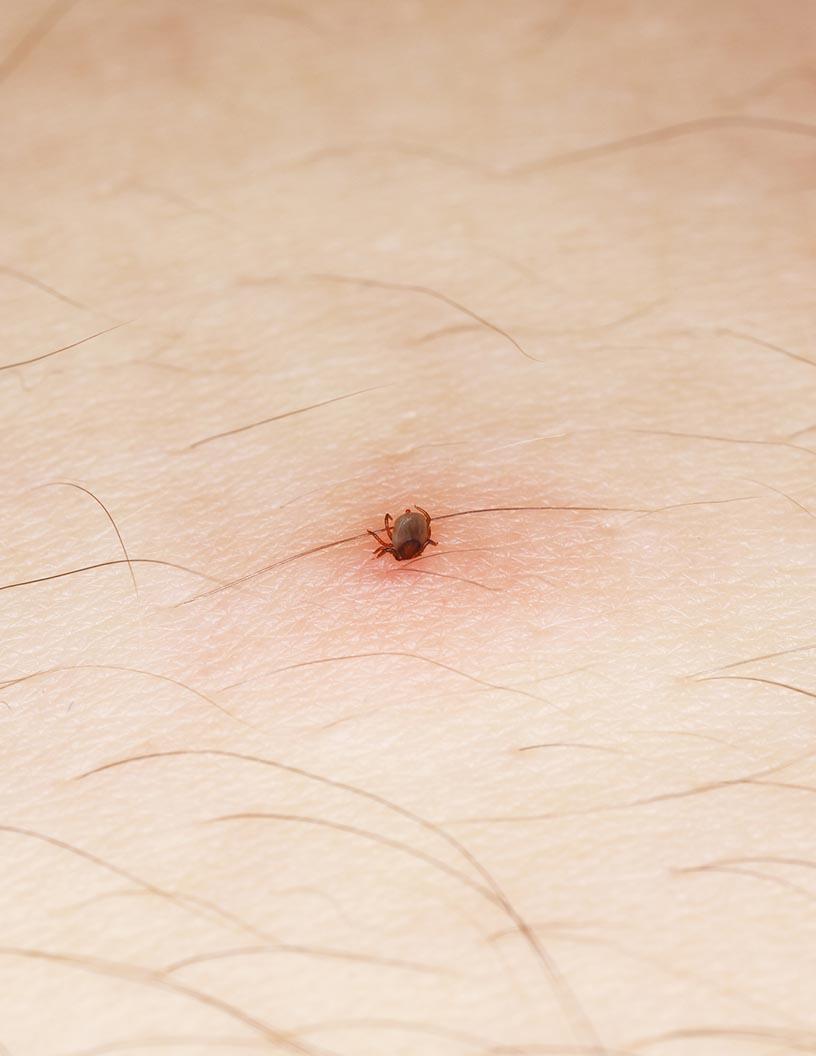 Facial Erythema Treatment Market Size North America, Europe, Asia, Rest of World (ROW) - US, Canada, Germany, China, UK, Italy, Japan, France, India, South Korea - Trends and Forecast Report 2024-2028