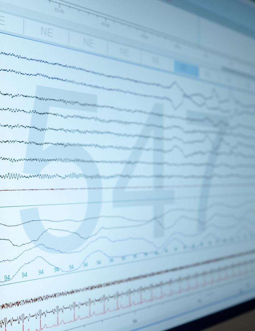 EEG Electrodes Market Analysis, Size, and Forecast 2025-2029: North America (US and Canada), Europe (France, Germany, Italy, and UK), APAC (China, India, and Japan), South America (Brazil), and Rest of World (ROW)