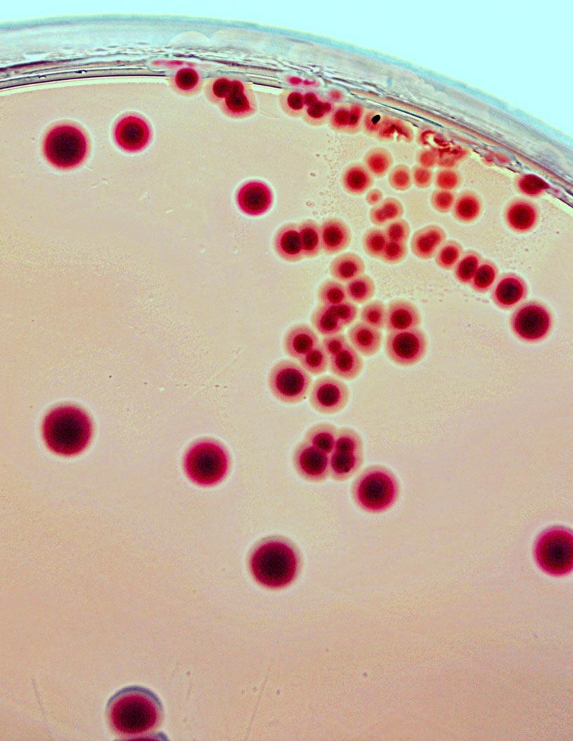 Escherichia Coli Testing Market Analysis, Size, and Forecast 2024-2028: North America (US and Canada), Europe (France, Germany, Italy, and UK), Middle East and Africa (UAE), APAC (China, India, Japan, and South Korea), and Rest of World (ROW)