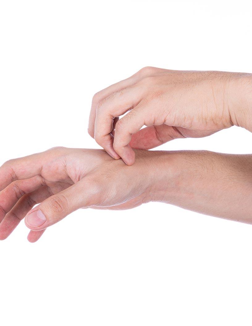 Pruritus Drugs Market Analysis North America, Europe, Asia, Rest of World (ROW) - US, UK, Germany, China, France - Size and Forecast 2024-2028