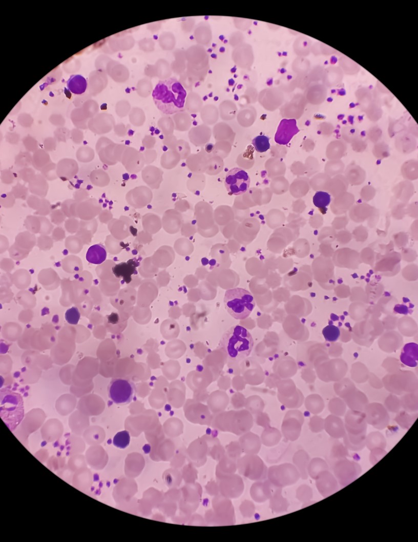 Scleroderma Therapeutics Market Analysis North America, Europe, Asia, Rest of World (ROW) - Canada, US, Denmark, China, India - Size and Forecast 2024-2028