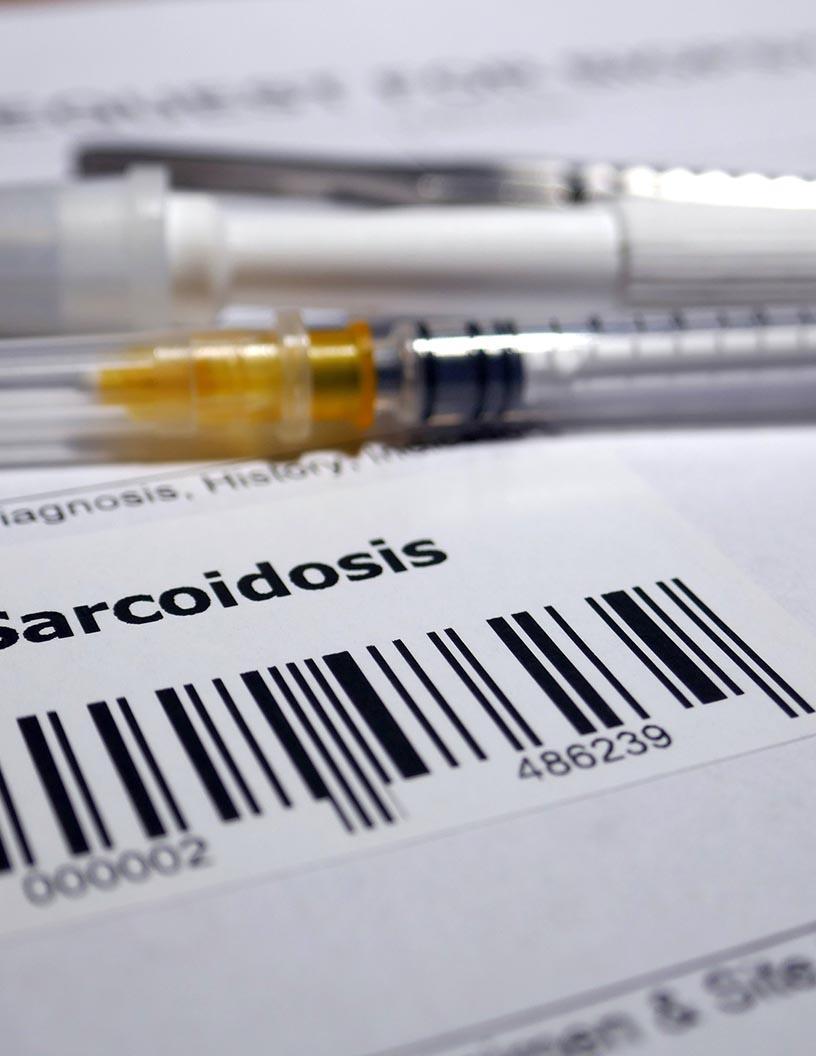 Sarcoidosis Therapeutics Market Analysis, Size, and Forecast 2025-2029: North America (US and Canada), Europe (France, Germany, Italy, and UK), APAC (China, India, and Japan), South America (Brazil), and Rest of World (ROW)