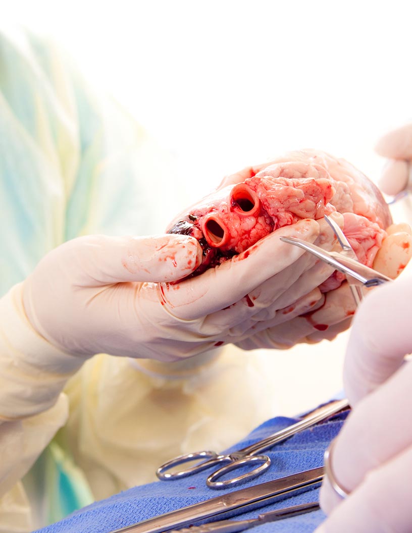 Vascular Grafts Market Analysis North America, Europe, Asia, Rest of World (ROW) - US, Germany, UK, Canada, China - Size and Forecast 2024-2028