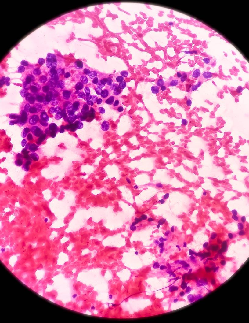 Liver Cancer Drugs Market Analysis, Size, and Forecast 2025-2029: North America (US and Canada), Europe (France, Germany, Italy, UK), Middle East and Africa , APAC (China, India, Japan, South Korea), South America , and Rest of World (ROW)