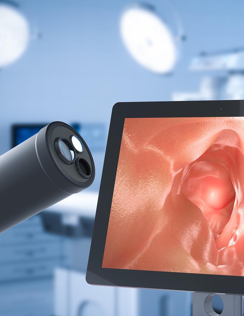South Africa Endoscopy Devices Market Analysis - Size and Forecast 2024-2028