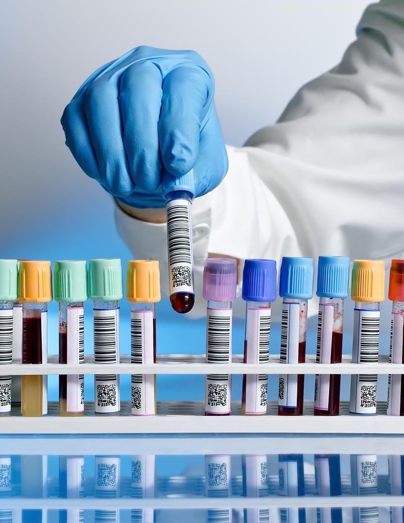 Carrier Screening Market Analysis, Size, and Forecast 2025-2029: North America (US and Canada), Europe (France, Germany, Italy, Spain, and UK), APAC (China, India, and Japan), and Rest of World (ROW)