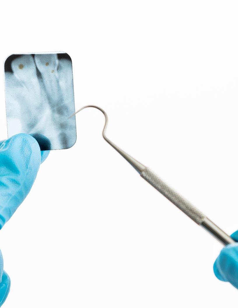 Bone Staple Systems Market Analysis, Size, and Forecast 2025-2029: North America (US and Canada), Europe (France, Germany, Italy, Spain, and UK), APAC (China, India, and Japan), and Rest of World (ROW)