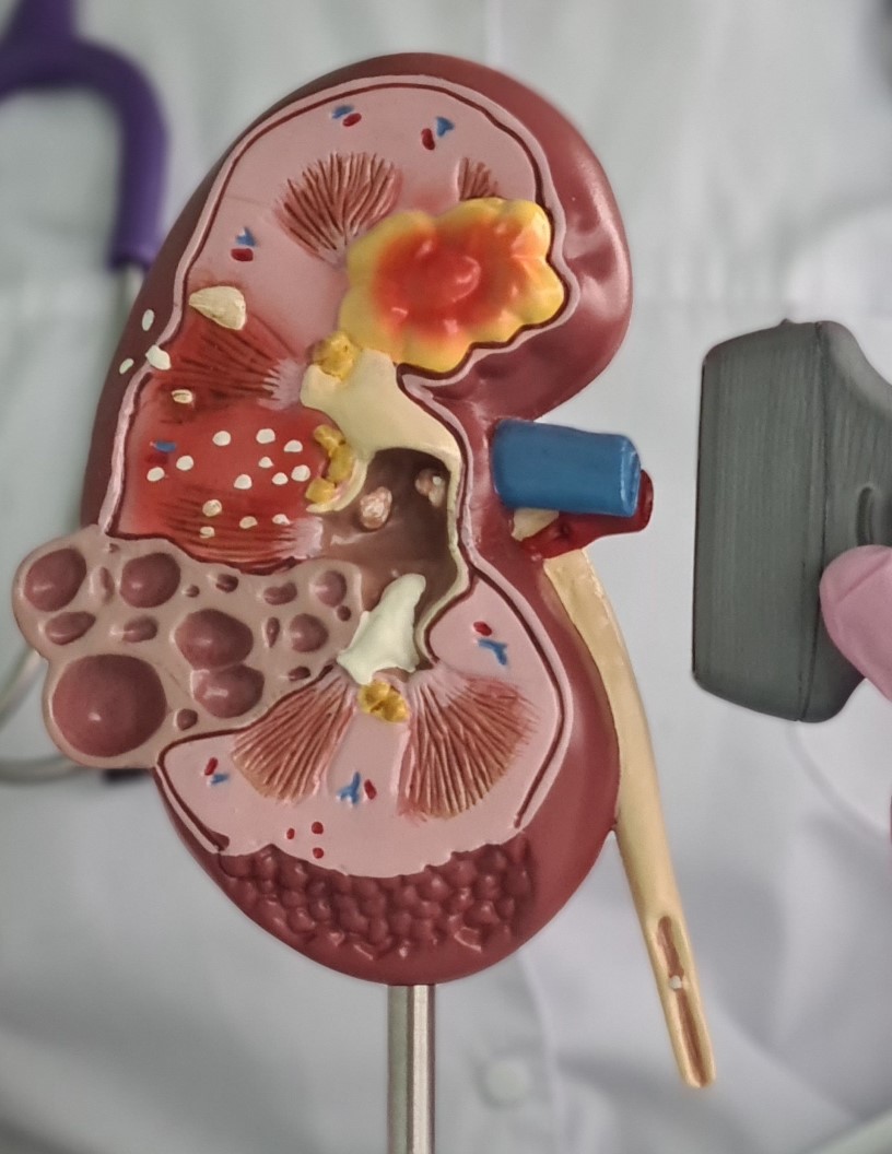 Kidney Stones Management Devices Market Analysis North America, Europe, Asia, Rest of World (ROW) - US, Germany, UK, China, France - Size and Forecast 2024-2028