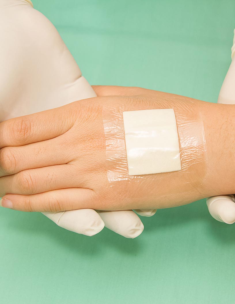 Fibrin Sealants Market Analysis North America, Europe, Asia, Rest of World (ROW) - US, Canada, Germany, France, Japan - Size and Forecast 2024-2028