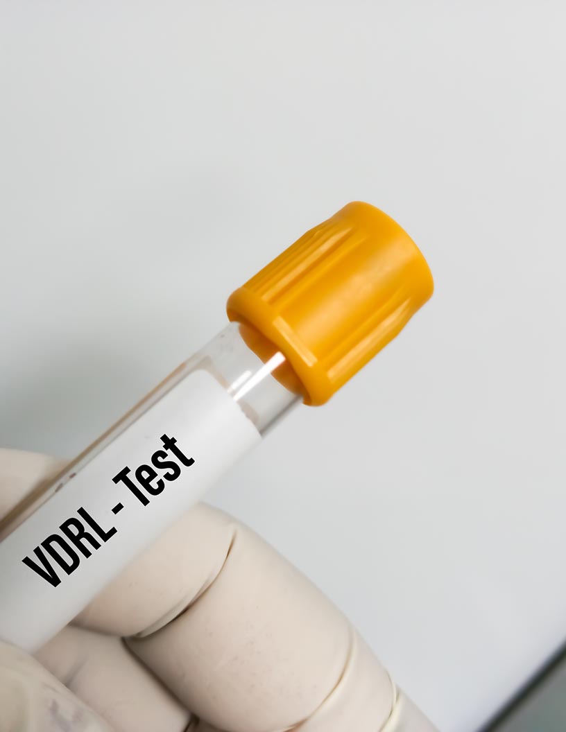 Rapid Plasma Reagin Test Market Analysis North America, Europe, Asia, Rest of World (ROW) - US, France, China, Germany, Canada - Size and Forecast 2024-2028