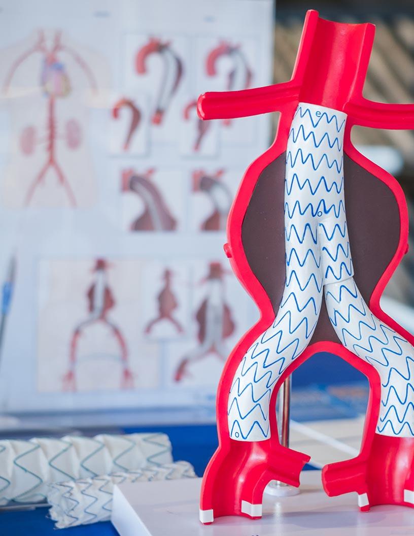 Aneurysm Coiling And Embolization Devices Market Analysis North America, Europe, Asia, Rest of World (ROW) - US, Denmark, China, Canada, India, Sweden, Germany, Mexico, UK, Japan - Size and Forecast 2025-2029