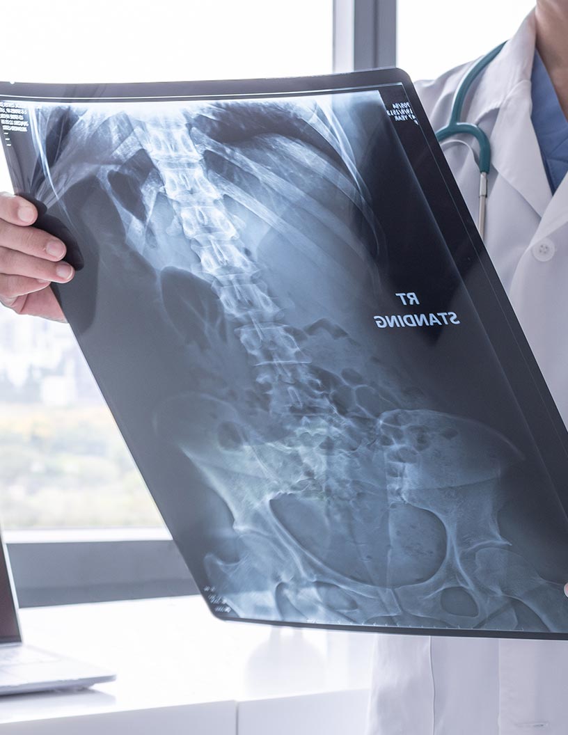 Gastrointestinal Bleeding Treatment Market Analysis North America, Europe, Asia, Rest of World (ROW) - US, Germany, UK, China, Japan - Size and Forecast 2024-2028