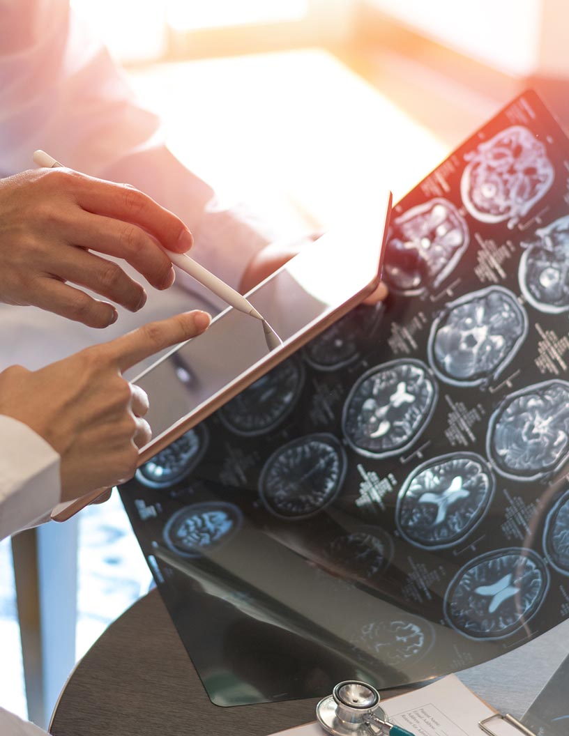 Intracranial Pressure (ICP) Monitoring Devices Market Analysis North America, Europe, Asia, Rest of World (ROW) - US, Germany, UK, China, Japan - Size and Forecast 2024-2028