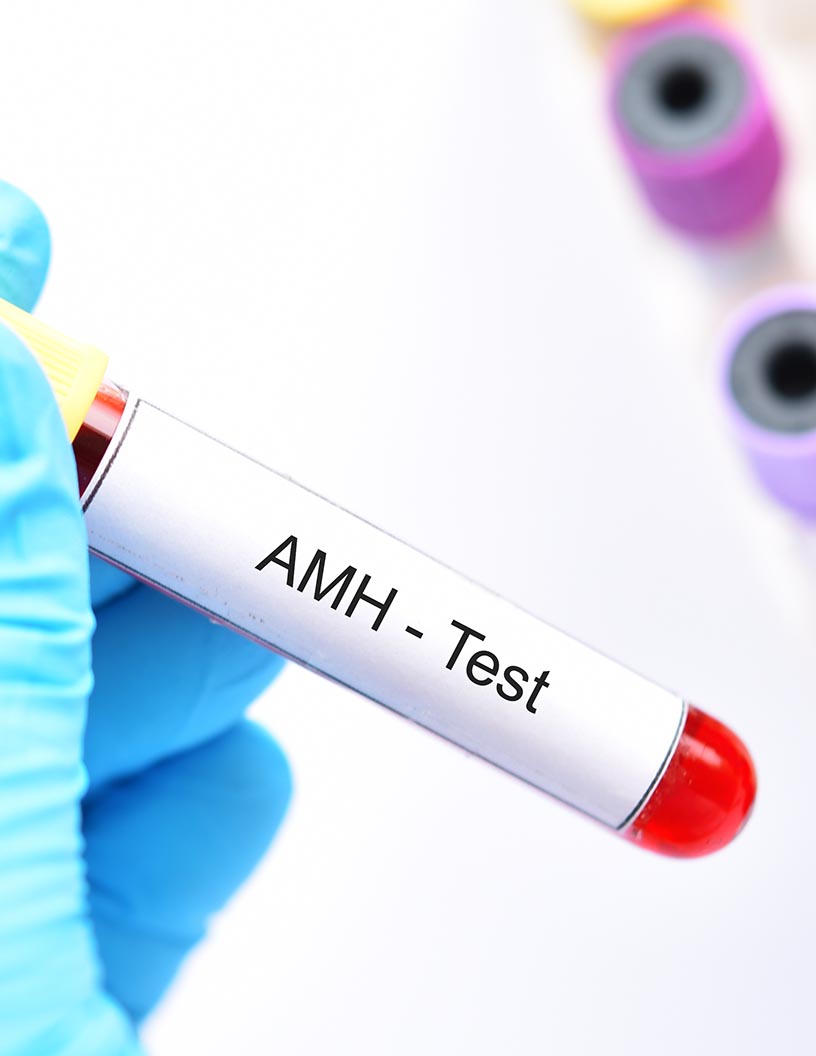 Male Hypogonadism Market Analysis North America, Europe, Asia, Rest of World (ROW) - US, Germany, China, UK, Canada - Size and Forecast 2024-2028