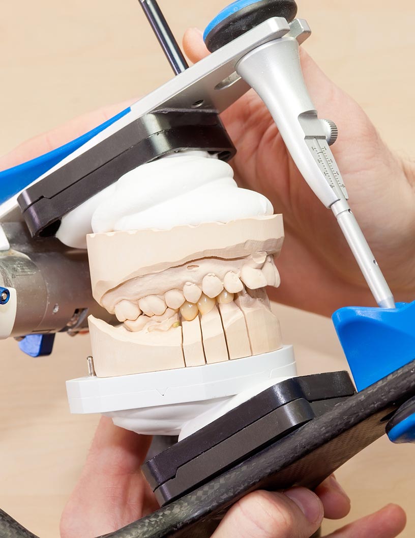 Facial Implants Market Analysis North America, Europe, Asia, Rest of World (ROW) - US, Germany, UK, China, Canada - Size and Forecast 2024-2028