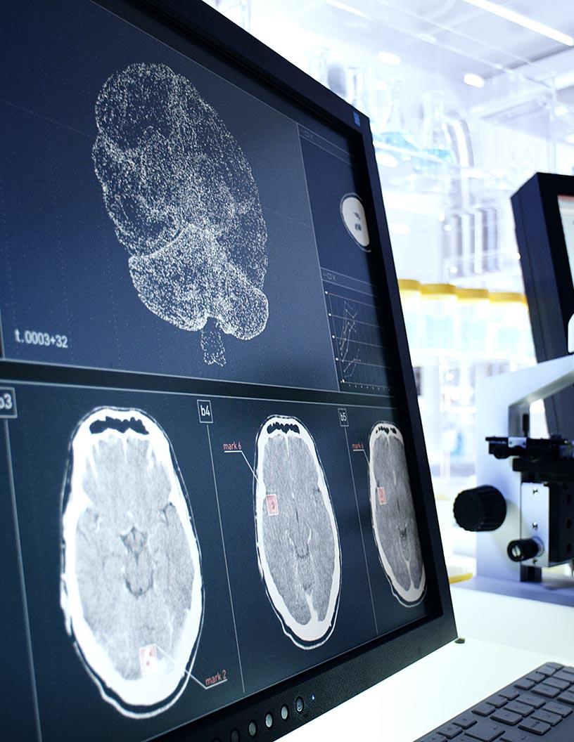 Neurodegenerative Diseases Therapeutics Market Analysis, Size, and Forecast 2025-2029: North America (US and Canada), Europe (France, Germany, Italy, and UK), APAC (China, India, Japan, and South Korea), and Rest of World (ROW)