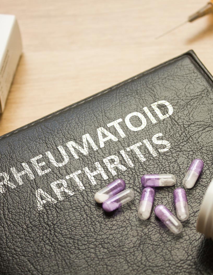 Rheumatoid Arthritis Drugs Market Analysis North America, Europe, Asia, Rest of World (ROW) - US, UK, Germany, France, China - Size and Forecast 2024-2028