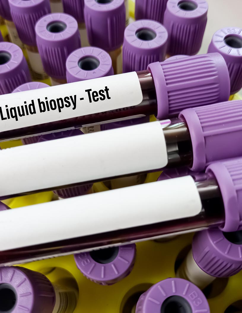 Breast Cancer Liquid Biopsy Market Analysis, Size, and Forecast 2024-2028: North America (US and Canada), Europe (France, Germany, Italy, and UK), Middle East and Africa (Egypt, KSA, Oman, and UAE), APAC (China, India, and Japan), South America (Argentina and Brazil), and Rest of World (ROW)