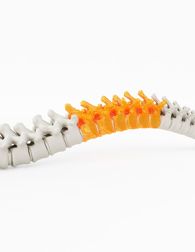 Bone Grafts and Substitutes Market Analysis North America, Europe, Asia, Rest of World (ROW) - US, Germany, UK, China, Japan - Size and Forecast 2024-2028