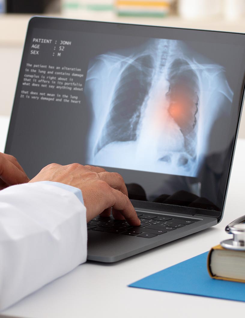 Pulmonary Edema Therapeutics Market Analysis North America, Europe, Asia, Rest of World (ROW) - US, Germany, UK, China, Canada - Size and Forecast 2024-2028