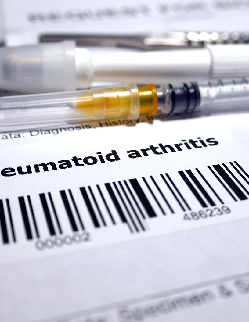 Rheumatoid Arthritis Diagnostic Devices Market Analysis North America, Europe, Asia, Rest of World (ROW) - US, Germany, France, Canada, Japan - Size and Forecast 2024-2028