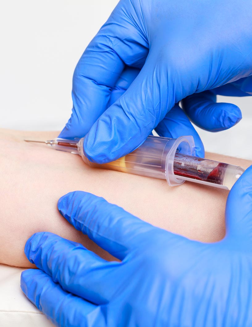 Venous Blood Collection Market Analysis North America, Asia, Europe, Rest of World (ROW) - US, China, India, Canada, Germany - Size and Forecast 2024-2028