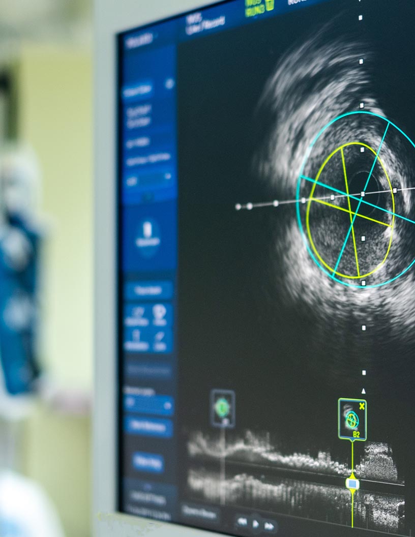 Cardiovascular Ultrasound Imaging Systems Market Analysis North America, Europe, Asia, Rest of World (ROW) - US, Denmark, China, Canada, India - Size and Forecast 2024-2028