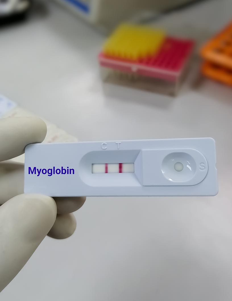 Myoglobin Market Analysis North America, Europe, Asia, Rest of World (ROW) - US, China, Germany, Canada, UK - Size and Forecast 2024-2028