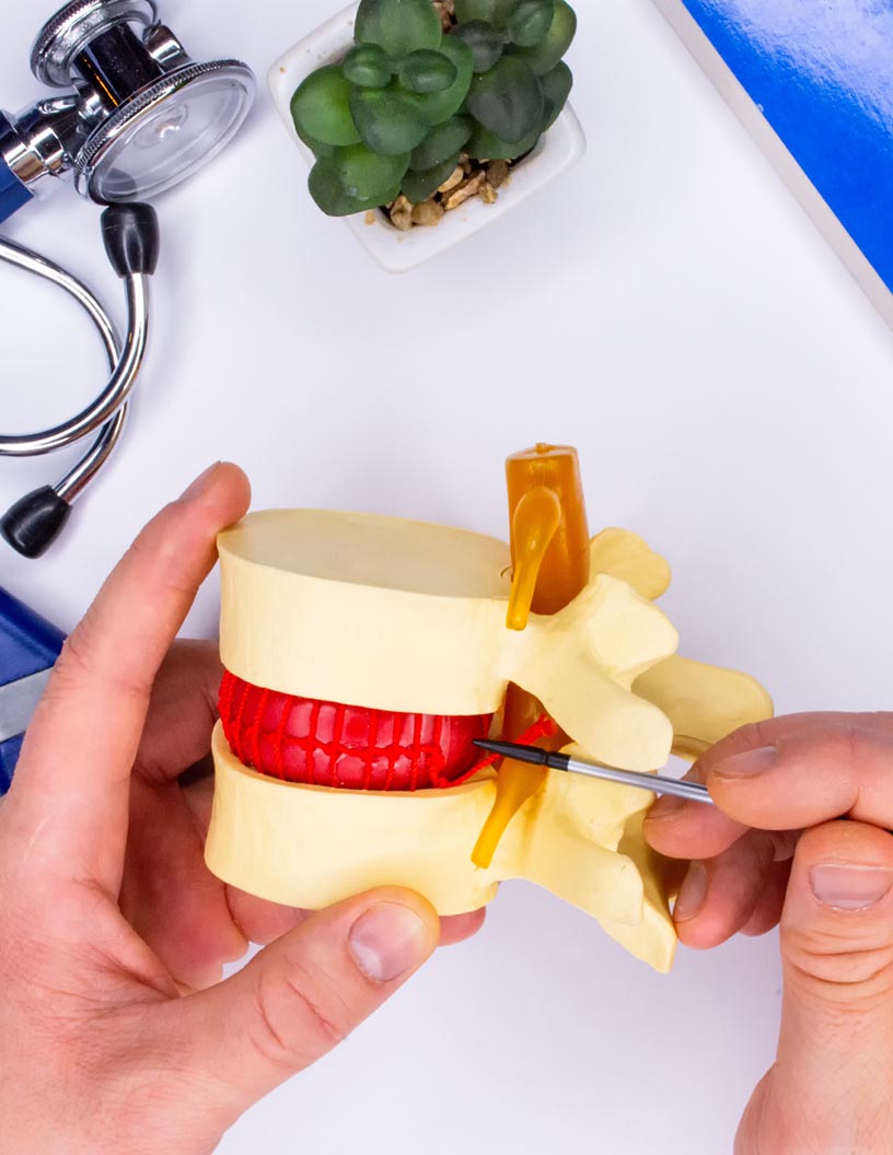 Degenerative Disc Disease Market Analysis North America, Europe, Asia, Rest of World (ROW) - US, Germany, UK, China, Japan - Size and Forecast 2024-2028