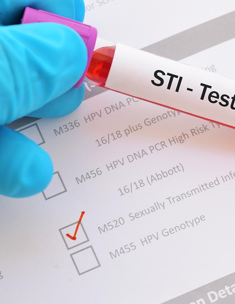 Sexually Transmitted Diseases (STD) Treatment Market Analysis, Size, and Forecast 2025-2029: North America (US and Canada), Europe (France, Germany, Italy, Spain, and UK), APAC (China, India, and Japan), and Rest of World (ROW)