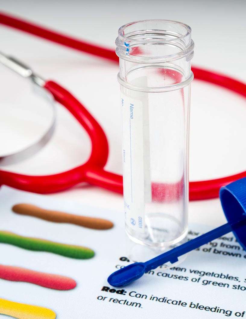 Stool Testing Market Analysis North America, Europe, Asia, Rest of World (ROW) - US, Canada, UK, Germany, China - Size and Forecast 2024-2028