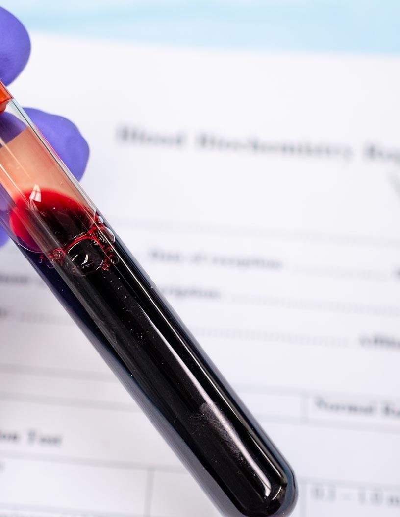 Blood Market Analysis, Size, and Forecast 2025-2029: North America (US and Canada), Europe (France, Germany, Italy, and UK), APAC (China, India, Japan, and South Korea), and Rest of World (ROW)