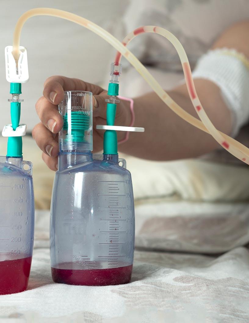 Surgical Drainage Devices Market Analysis North America, Europe, Asia, Rest of World (ROW) - US, China, Japan, Canada, Germany, India, UK, South Korea, France, Italy - Size and Forecast 2024-2028