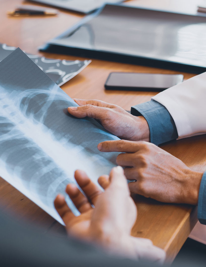 Pneumonia Testing Market Analysis North America, Europe, Asia, Rest of World (ROW) - US, China, Germany, UK, Japan - Size and Forecast 2024-2028