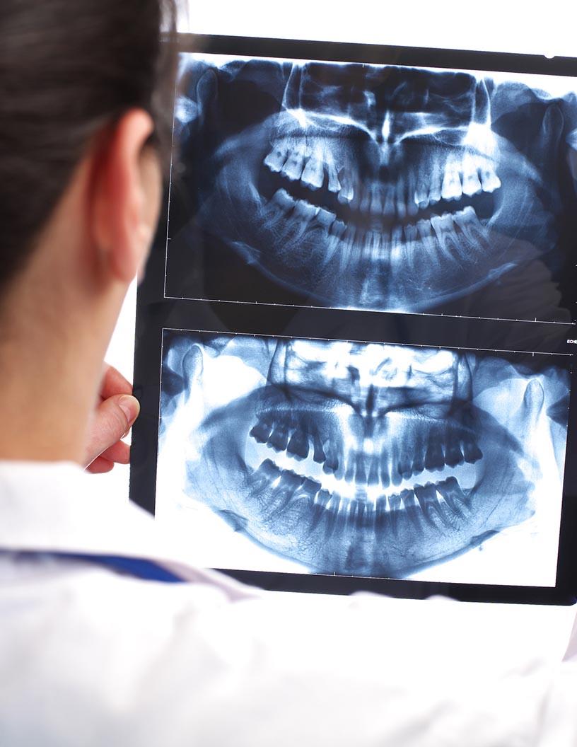 Dental Imaging Market Analysis, Size, and Forecast 2025-2029: North America (US and Canada), Europe (France, Germany, Italy, and UK), APAC (China, India, Japan, and South Korea), and Rest of World (ROW)