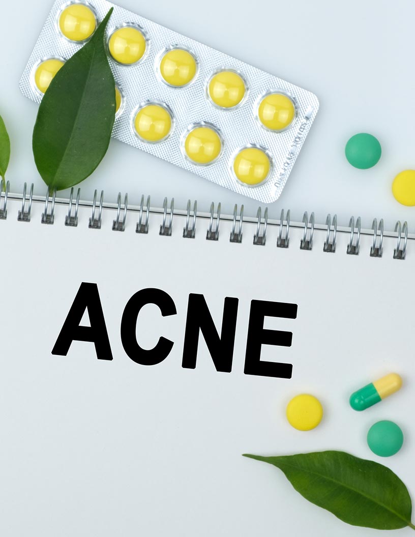 Acne Drugs Market Analysis North America, Europe, Asia, Rest of World (ROW) - US, Germany, UK, China, Japan - Size and Forecast 2024-2028