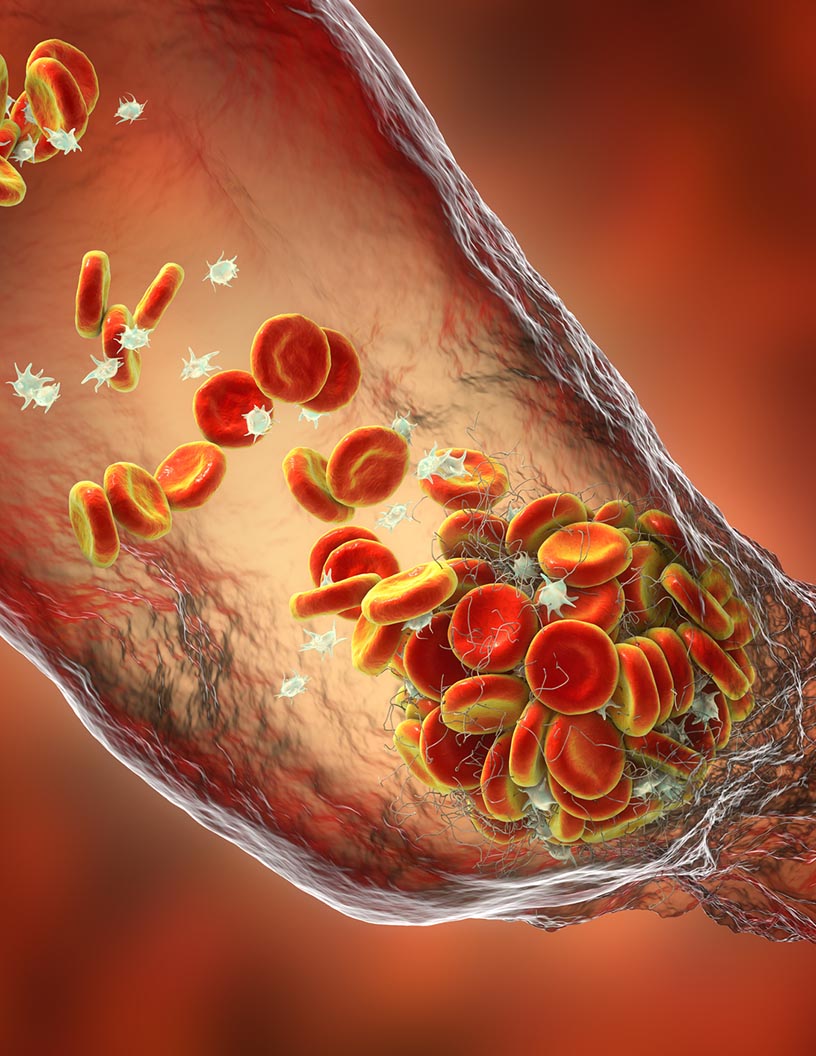Pulmonary Arterial Hypertension (PAH) Drugs Market Analysis North America, Europe, Asia, Rest of World (ROW) - US, UK, Germany, Canada, Japan - Size and Forecast 2024-2028