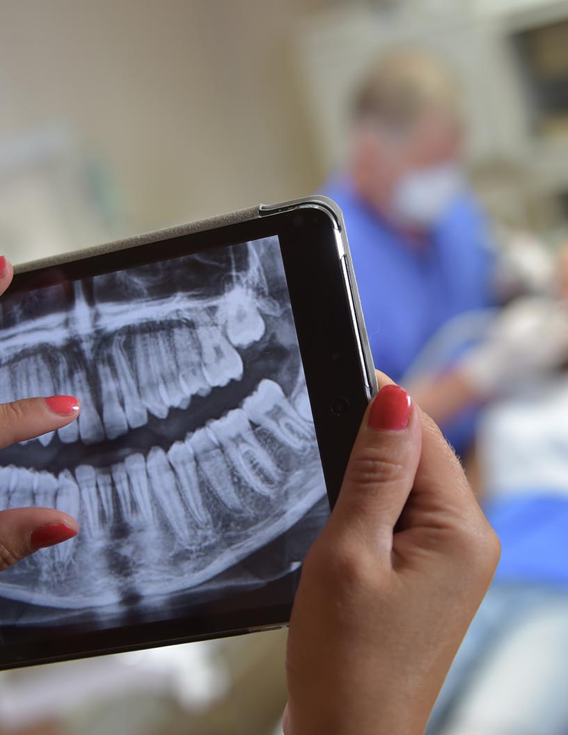 Dental X Ray Market Analysis North America, Europe, Asia, Rest of World (ROW) - US, Germany, Japan, China, Canada - Size and Forecast 2024-2028