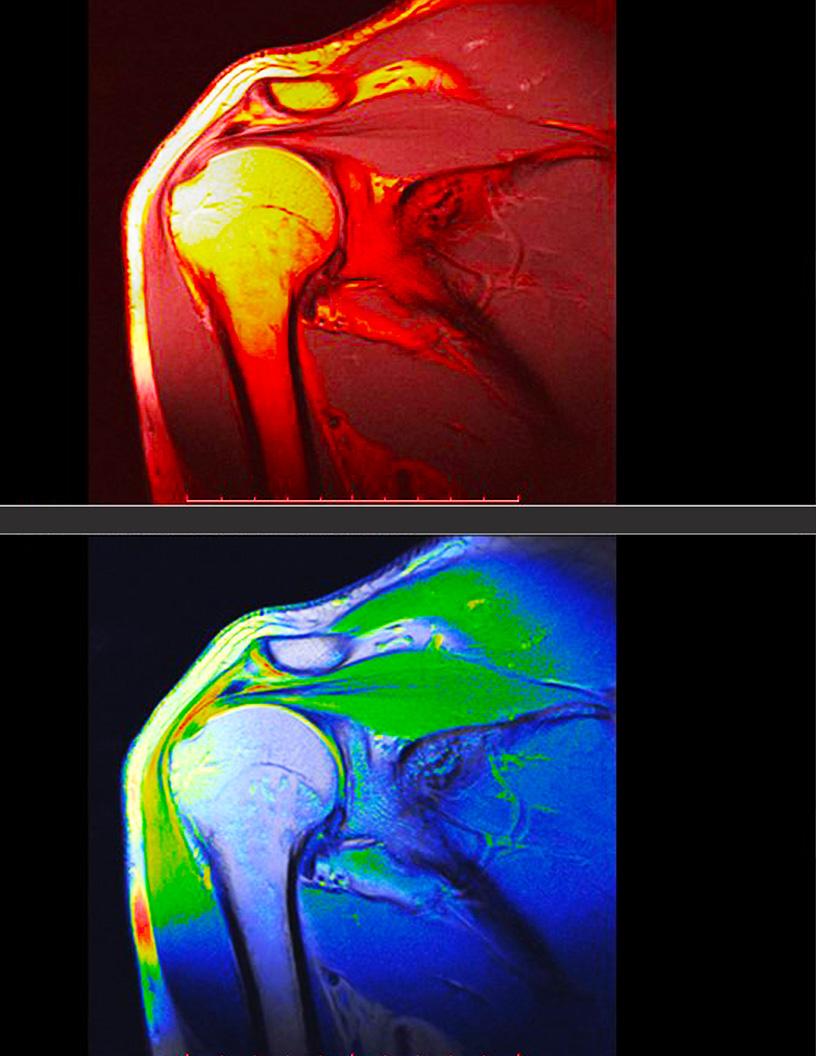 Contrast Media Market Analysis North America, Europe, APAC, South America, Middle East and Africa - US, Japan, Germany, China, UK - Size and Forecast 2024-2028
