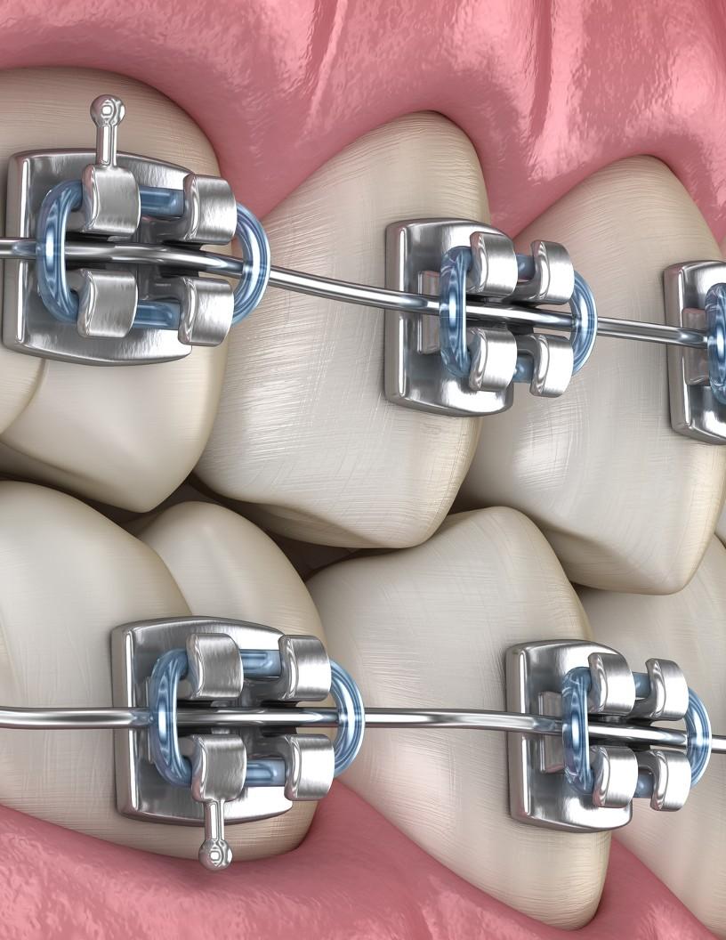 US Dental Chains Market Analysis, Size, and Forecast 2025-2029
