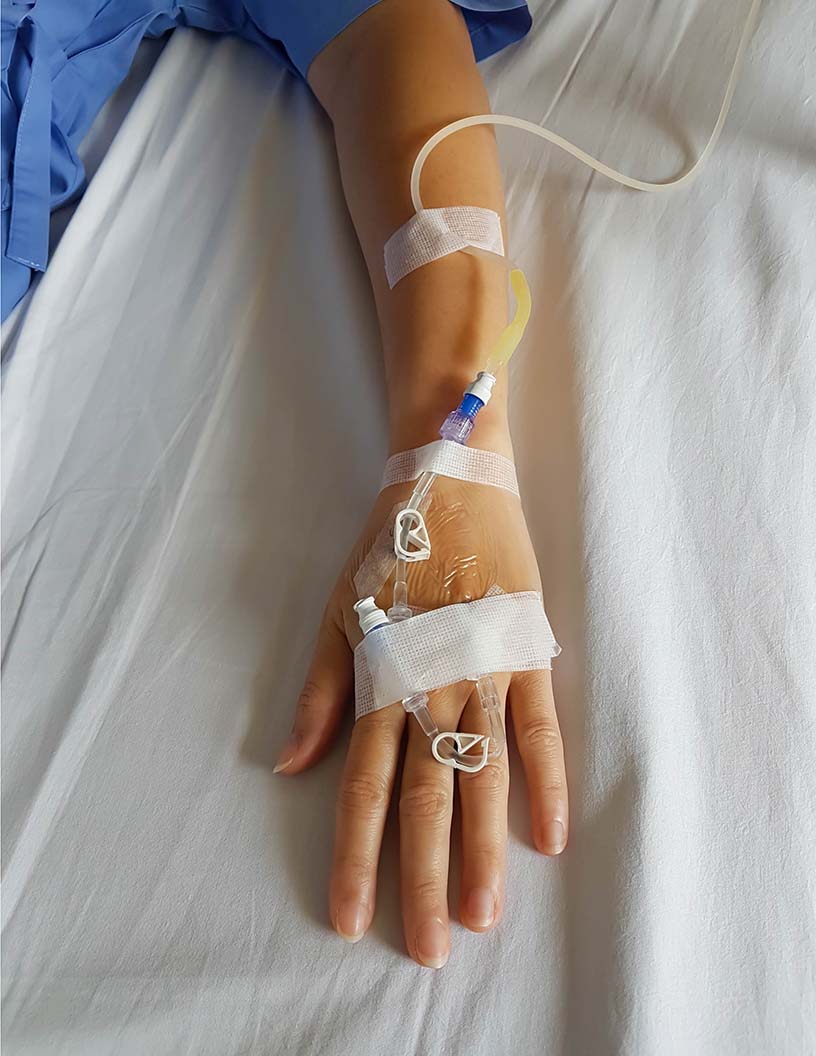 Intravenous (Iv) Therapy And Vein Access Market Analysis North America, Europe, Asia, Rest of World (ROW) - US, Germany, Japan, France, Canada - Size and Forecast 2024-2028