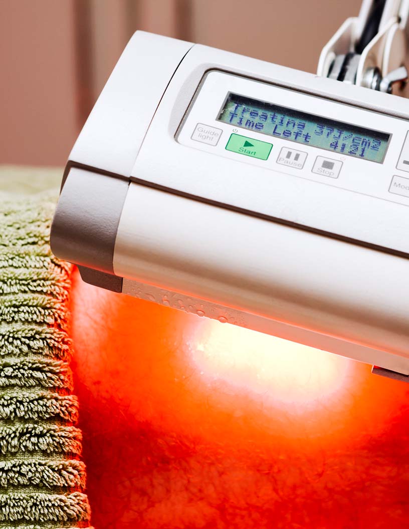 Photodynamic Therapy (PDT) Market Analysis North America, Europe, Asia, Rest of World (ROW) - US, UK, Germany, China, France - Size and Forecast 2024-2028