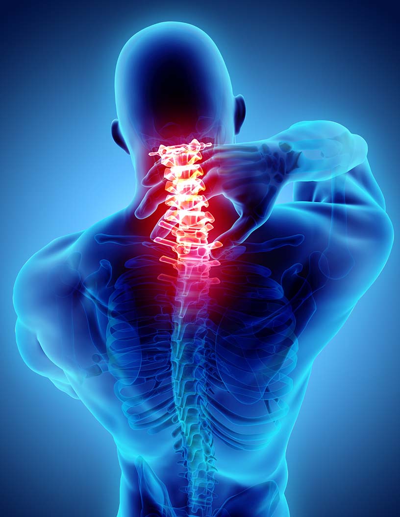 Neuromyelitis Optica Spectrum Disorder (NMOSD) Market Analysis North America, Europe, Asia, Rest of World (ROW) - US, UK, China, Canada, India - Size and Forecast 2024-2028