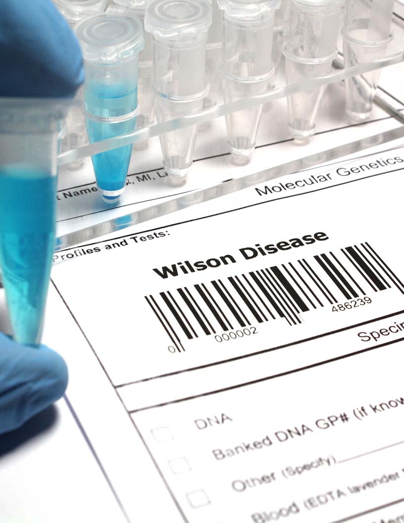 Wilson'S Disease (WD) Drugs Market Analysis North America, Europe, Asia, Rest of World (ROW) - US, Germany, UK, Canada, China - Size and Forecast 2024-2028